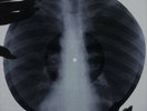 Who - Substitute  X-RAY USSR ROENTGEN Bones Record