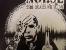 Noi se - The Scars We Hide LP CLEAR VINYL COCK SPARRER BUSINESS COCKNEY REJECTS