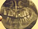 ANIMALS -HOUSE OF THE RISING SUN -USSR GEORGIA X-RAY ROENTGEN SKULL TEETH RECORD