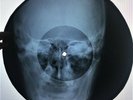 Queen - Bohemian Rhapsody X-RAY USSR ROENTGEN Bones Records SKULL