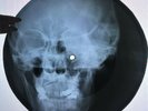 Bob Marley - Sun Is Shining X-RAY USSR ROENTGEN Bones Records SKULL