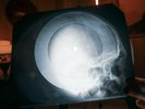 Led Zeppelin Ramble On X Ray USSR Vinyl Record Music on Bones Roentgen