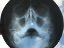 ANIMALS - SEE SEE RIDER - UNIQUE USSR GEORGIAN X-RAY ROENTGEN SKULL BONES RECORD