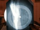 Lesley Gore California Nights X-Ray USSR Vinyl Record Music on Bones Roentgen
