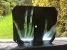 Rare Pink Floyd - Astronomy Domine - Soviet Bone Music On X-ray - Watch Video