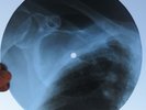 NINA SIMONE - FEELING GOOD - UNIQUE USSR GEORGIAN X-RAY ROENTGEN BONES RECORD
