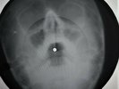 Doors - Light My Fire  X-RAY OF THE USSR BONE X-RAY RECORDING 9,2