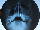 BEATLES - WE CAN WORK IT OUT -UNIQUE USSR GEORGIAN X-RAY ROENTGEN SKULL RECORD
