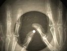 Bob Dylan - Lay, Lady, Lay X-RAY BONE OF THE USSR X-RAY RECORDING