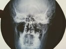 Elvis Presley - Lover Doll X-RAY OF THE USSR BONE X-RAY RECORDING  9.1
