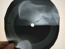 LLOYD PRICE STAGGER LEE X-Ray USSR Record Roentgen Bones Ribs Music Vinyl