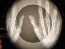 Kinks - You Really Got Me X-RAY BONE OF THE USSR X-RAY RECORDING