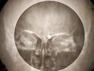 Shadows - Man of Mystery X-RAY BONE OF THE USSR X-RAY RECORDING