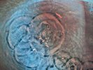 Pink Floyd - Meddle / Echoes - 1971 UK A4/B3 First Pressing - Textured 12” Vinyl