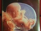 MOTRIP EMBRYO -  2 LP Vinyl - feat. Marsimoto NEU & OVP