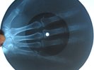 JERRY LEE LEWIS - BOOGIE WOOGIE COUNTRY GIRL - USSR GEORGIAN X-RAY BONES RECORD