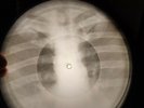 Jimi Hendrix - Hey Joe X-RAY USSR BONE RECORDING X-RAY