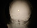 Rolling Stones - Not Fade Away X-RAY USSR X-RAY BONE RECORDING