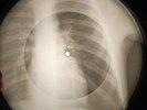 Benny Goodman - Let's Dance X-RAY USSR BONE RECORDING