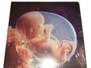 MoTrip - Embryo Vinyl 2LP