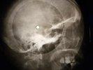 Bob Dylan - Knockin On Heavens Door X-RAY OF THE USSR X-RAY BONES RECORD