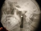 Beatles - Get Back X-RAY OF USSR X-RAY BONES RECORD