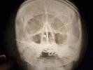 Rolling Stones - Jumping Jack Flash X-RAY OF THE USSR RECORDING BONES
