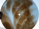 EVERLY BROTHERS - WAKE UP LITTLE SUSIE - GEORGIAN X-RAY ROENTGEN BONES RECORD