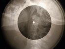 Who - Baba O'riley X-RAY OF THE USSR X-RAY BONE RECORDING