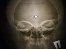 Beatles - No Reply X-RAY OF THE USSR X-RAY BONE RECORDING