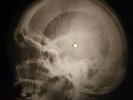 Bob Marley - Three Little Birds X-RAY OF THE USSR X-RAY BONE RECORDING