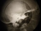 Chuck Berry - Memphis Tennessse X-RAY OF USSR X-RAY BONE RECORDING