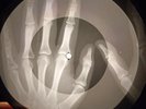 Beatles - Flying X-RAY OF THE  USSR X-RAY BONES RECORDING