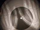 Ray Charles - Crying Time X-RAY OF USSR X-RAY BONE RECORDING