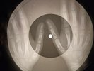 Ricky Nelson - Teenage Idol X-RAY OF THE USSR X-RAY BONES RECORD