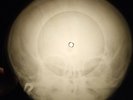 Led Zeppelin - Good Times Bad Times X-RAY OF USSR X-RAY BONES RECORDING
