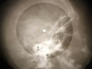 Kinks - A Well Respected Man X-RAY OF THE  USSR X-RAY BONES RECORDING