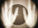 Beatles - Baby You're a Rich Man X-RAY OF THE USSR BONE RECORDING