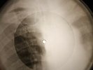 Drifters - Up On The Roof X-RAY OF THE USSR X-RAY BONE RECORDING