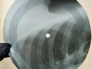 ROLLING STONES STUPID GIRL X-Ray USSR Record Roentgen Bones Ribs Music Vinyl