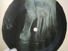 ROLLING STONES OH BABY X-Ray USSR Record Roentgen Bones Ribs Music Vinyl