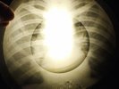 Beatles - Ticket To Ride X-RAY OF USSR X-RAY BONES RECORDING