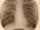 Beatles - Let It Be X-RAY OF THE USSR X-RAY BONES RECORDING