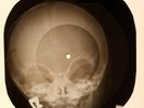 Rolling Stones - Stoned X-RAY OF THE USSR X-RAY BONE RECORD