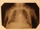 Elvis Presley - Surrender X-RAY OF USSR X-RAY BONE RECORDING