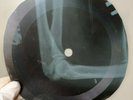 BEATLES ELEANOR RIGBY X-Ray USSR Record Roentgen Ribs Bones Music Vinyl