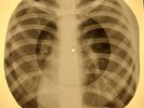Doors - Indian summer X-RAY OF USSR X-RAY BONE RECORDING