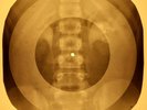 Kinks - All Day And All Of The Night  X-RAY OF USSR X-RAY BONE RECORD
