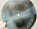 NINA SIMONE I RUT A SPELL  X-Ray USSR Record Roentgen Bones Ribs Music Vinyl