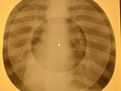 Andy Williamson - Love Story X-RAY OF THE USSR X-RAY BONES RECORDING